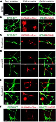 PDGF-BB signaling via PDGFR-β regulates the maturation of blood vessels generated upon vasculogenic differentiation of dental pulp stem cells